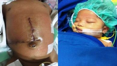 Bocah Penderita Sirosis Hati Asal Sungaipenuh Butuh Uluran Tangan