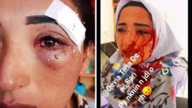 Tega!!! Suami Pukuli Istri Sampai Babak Belur