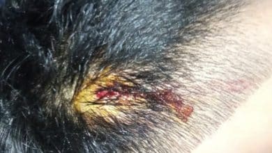 Aksi Ricuh di Sungai Penuh!, 4 Mahasiswa Dilarikan ke RS