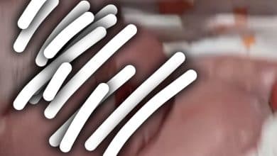 Pelayanan RS Ibu dan Anak Jambi Disorot, Anak Pertama NP Meninggal Dalam Kandungan Pelayanan RS Ibu dan Anak Jambi Disorot, Anak Pertama NP Meninggal Dalam Kandungan